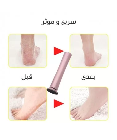سوهان کف پا شارژی