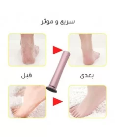 سوهان کف پا شارژی