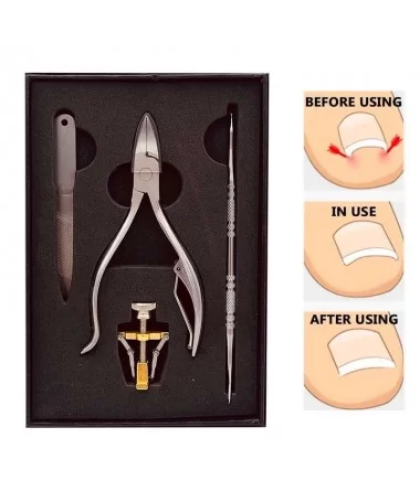 ست ابزار اصلاح ناخن 4 تکه